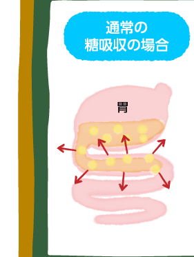通常の糖吸収のイメージ図